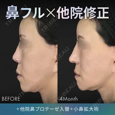 ジョウクリニック 銀座院 重本　譲医師の症例