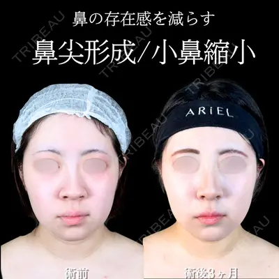 アリエル美容クリニック 大宮院 阪野 一世医師の症例