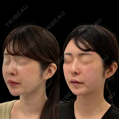 ルラ美容クリニック 池袋院 小海 元｜長期休暇につき指名不可医師の症例