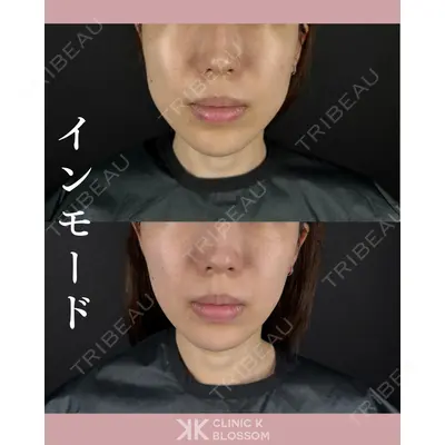Clinic K Blossomの症例