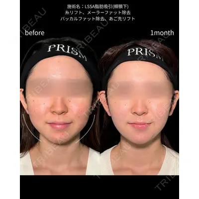 PRISM Beauty Clinic 町田院 森本 理一郎医師の症例