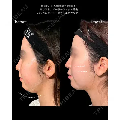 PRISM Beauty Clinic 町田院 森本 理一郎医師の症例