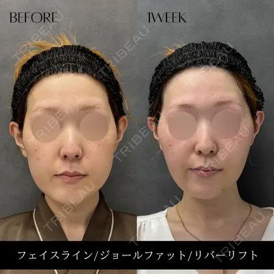 RIVER CLINIC（リバークリニック）大阪院の症例