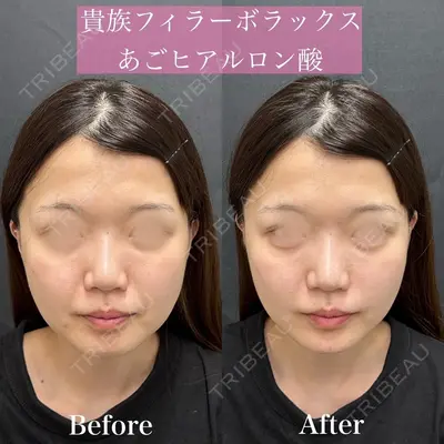 ルラ美容クリニック 渋谷本院 昼間 路子医師の症例