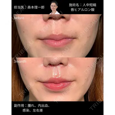 PRISM Beauty Clinic 町田院 森本 理一郎医師の症例