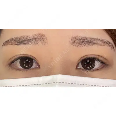 シンデレラ＆ダヴィンチクリニック 宮田 洋佑医師の症例