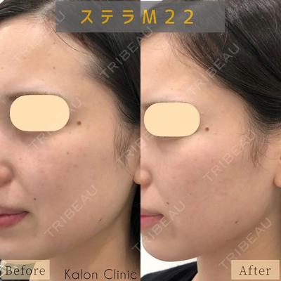 Kalon Clinic 原　千紘医師の症例