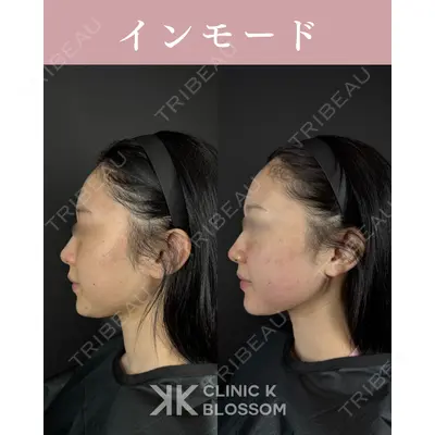 Clinic K Blossomの症例