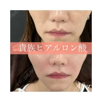 ルラ美容クリニック 郡山院 横瀬 晃平医師の症例