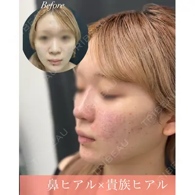 ルラ美容クリニック 郡山院 横瀬 晃平医師の症例