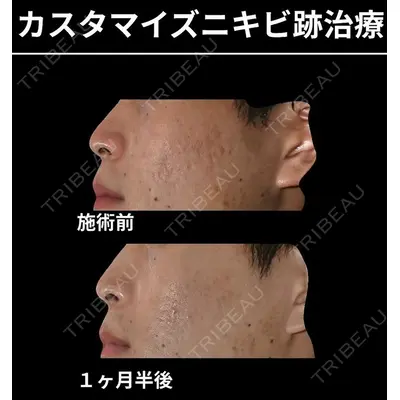 下北沢スキンクリニックの症例