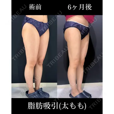 HAAB BEAUTY CLINIC 名古屋院の症例