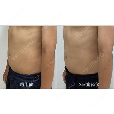 自由が丘ウェルエイジングビューティークリニック 福田 知佐子医師の症例