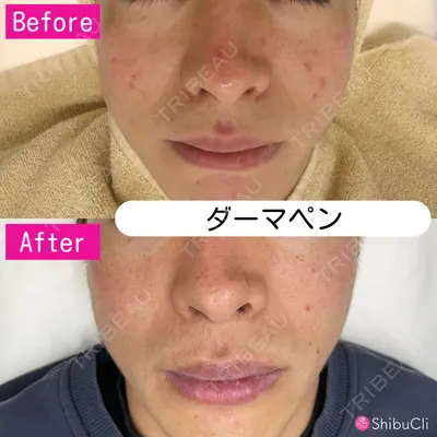 渋谷美容外科クリニック 横浜院の症例