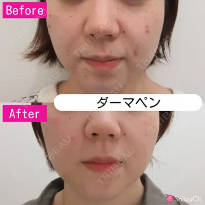 渋谷美容外科クリニック 横浜院の症例