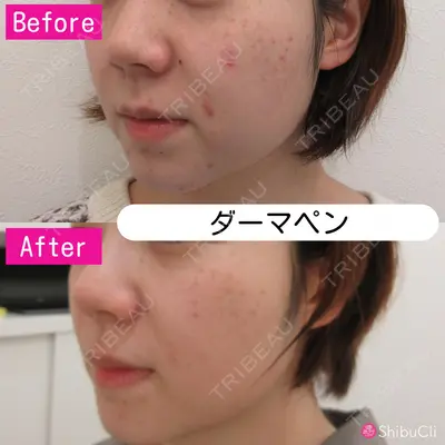 渋谷美容外科クリニック 横浜院の症例