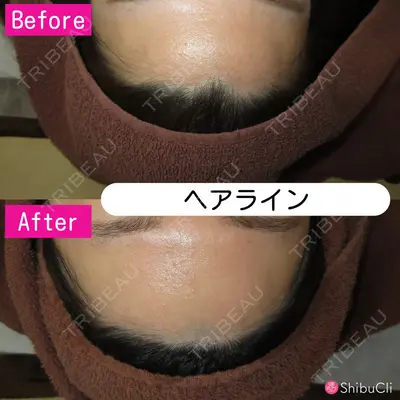 渋谷美容外科クリニック 新橋院の症例