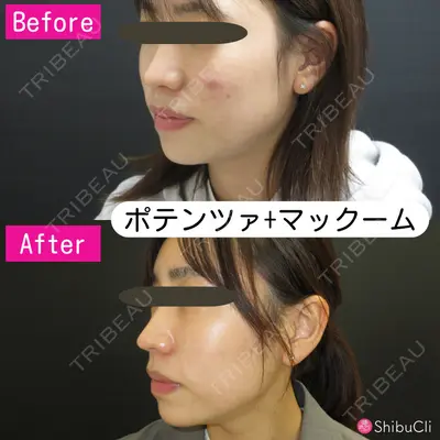 渋谷美容外科クリニック 横浜院の症例