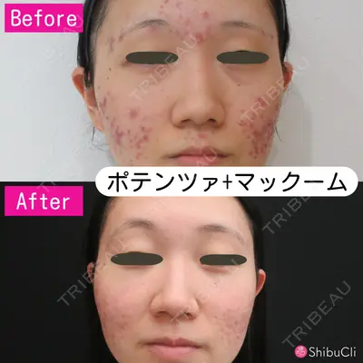 渋谷美容外科クリニック 横浜院の症例