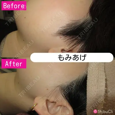 渋谷美容外科クリニック 新橋院の症例