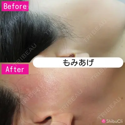 渋谷美容外科クリニック 新橋院の症例