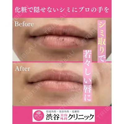 渋谷美容外科クリニック 新橋院の症例
