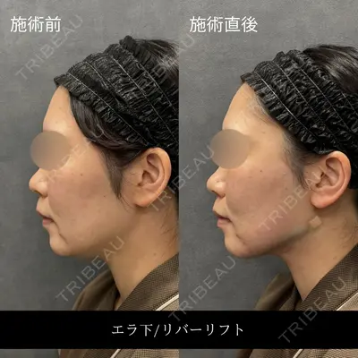 RIVER CLINIC（リバークリニック）大阪院 木家 佑理子医師の症例