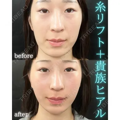 THE FIRST CLINIC 町田院の症例
