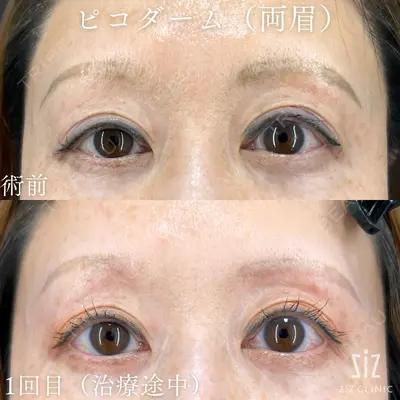 ziz CLINIC 村岡 史子医師の症例
