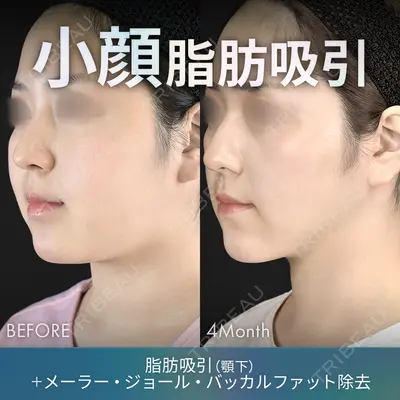 ジョウクリニック 那覇院の症例