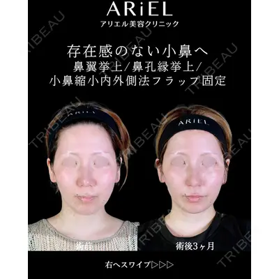 アリエル美容クリニック 大宮院の症例