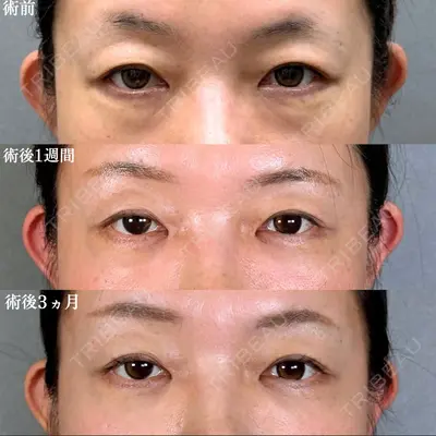 アリエル美容クリニック 水戸院 天白 典秀医師の症例