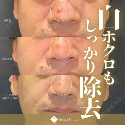 Fellez Clinic【フェルズクリニック】の症例