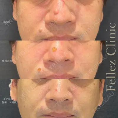 Fellez Clinic【フェルズクリニック】の症例