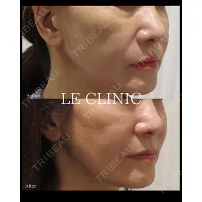 LE CLINICの症例