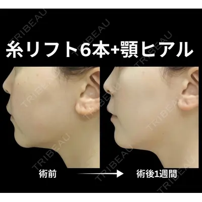 下北沢スキンクリニックの症例