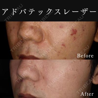 東京ココセランクリニック 篠﨑 智公医師の症例