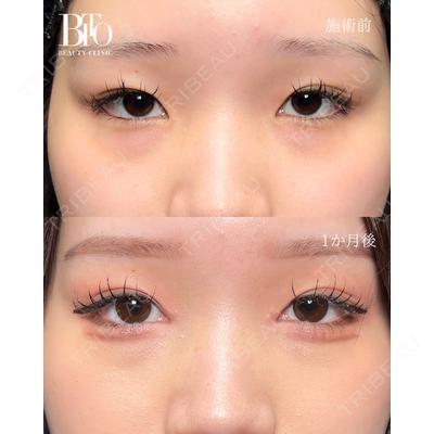 BITO BEAUTY CLINIC 伊藤 富良野医師の症例