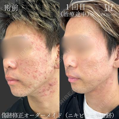 ziz CLINIC 村岡 史子医師の症例