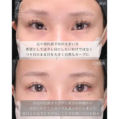 Zetith Beauty Clinic 大阪心斎橋院の症例