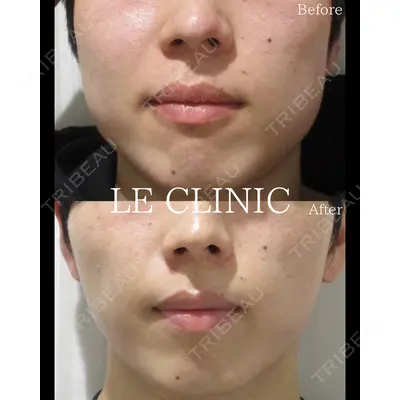 LE CLINICの症例