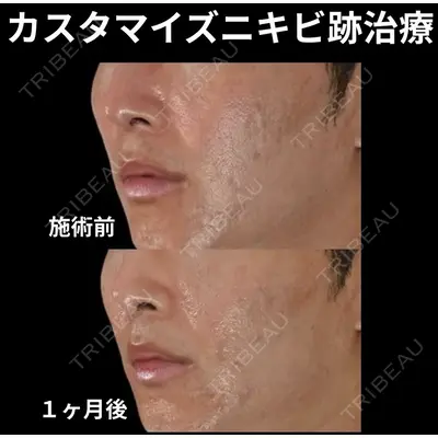 下北沢スキンクリニックの症例