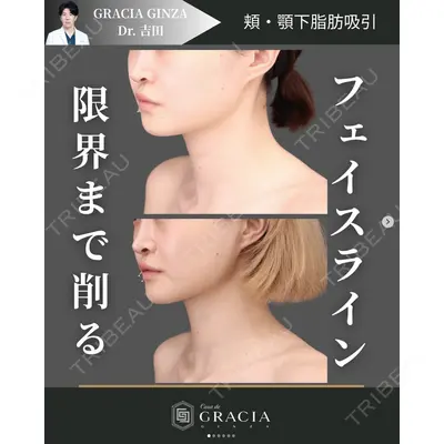 Casa de GRACIA GINZA 【カーサデグラシアギンザ】 吉田 直樹医師の症例