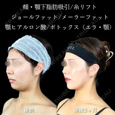 アリエル美容クリニック 大宮院 鈴木　桂介医師の症例