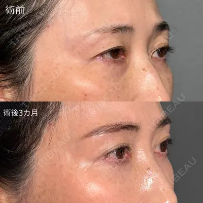 PRISM Beauty Clinic 町田院 森本 理一郎医師の症例