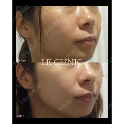 LE CLINICの症例