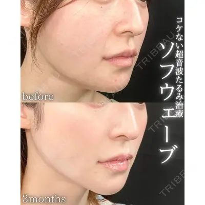 THE FIRST CLINIC 町田院の症例