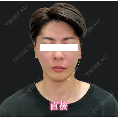 Ledian Clinic六本木 ヨシカワ　サヤカ医師の症例