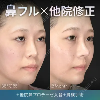 ジョウクリニック 銀座院 重本　譲医師の症例