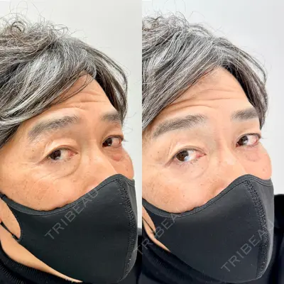D-ISMクリニック東京の症例